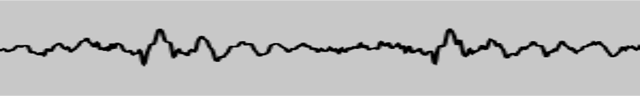 오디오 신호의 파형을 보여주는 검은색 오실로스코프 선